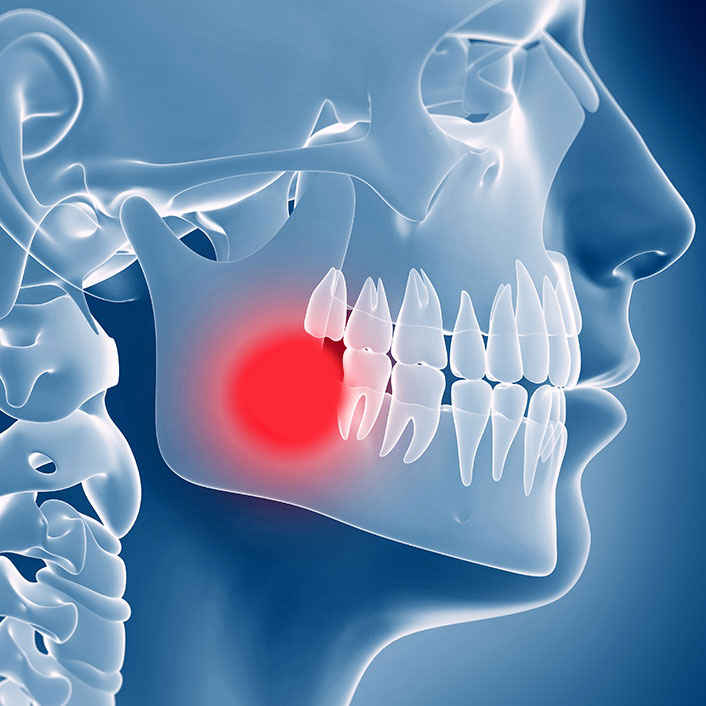 TMJ treatment